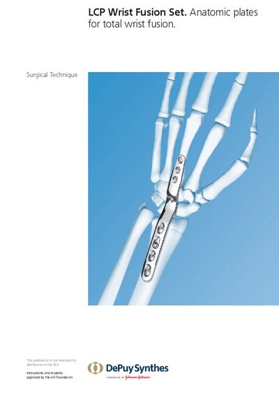 DePuy Synthes LCP Wrist Fusion Set Surgical Technique