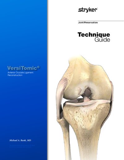 Stryker VersiTomic Anterior Cruciate Ligament Reconstruction Technique Guide - cover page