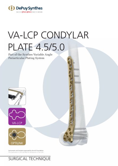 DePuy Synthes VA-LCP Condylar Plate 4.5/5.0 Surgical Technique - cover page